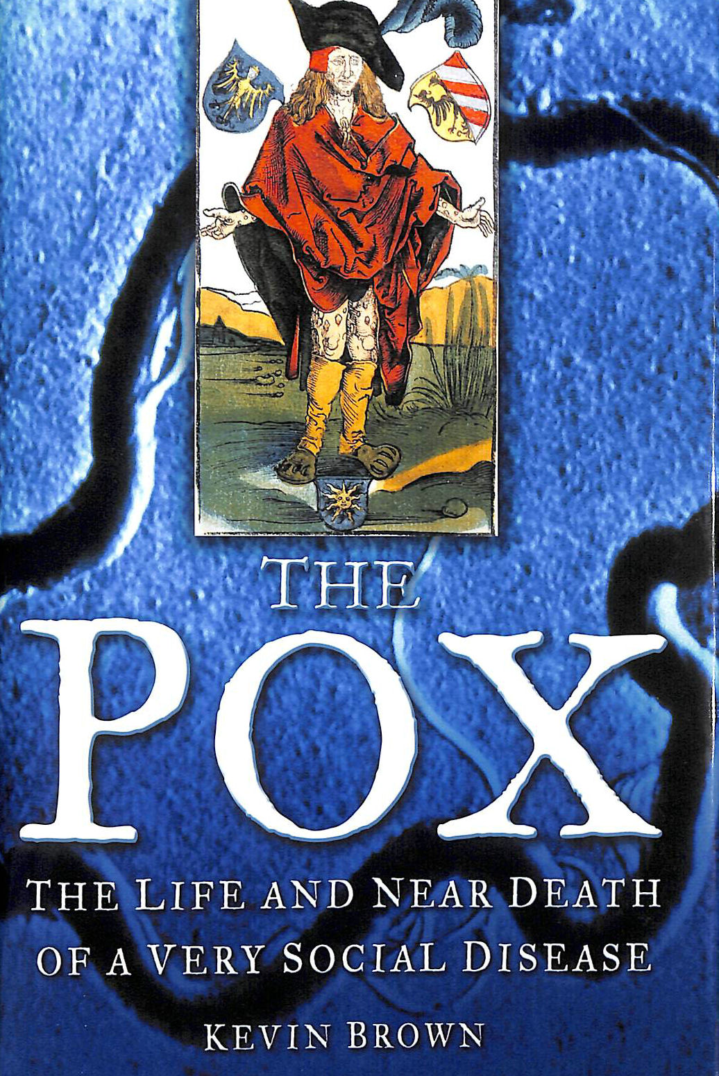 KEVIN BROWN - The Pox: The Life and Near Death of a Very Social Disease