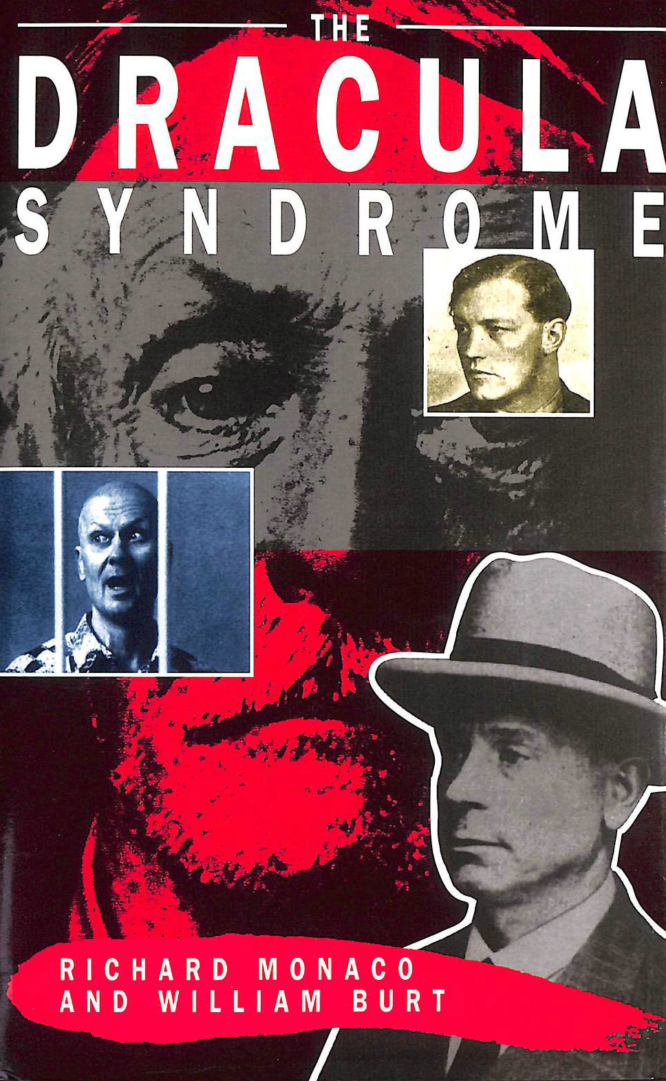 MONACO, RICHARD; BURT, WILLIAM - Dracula Syndrome